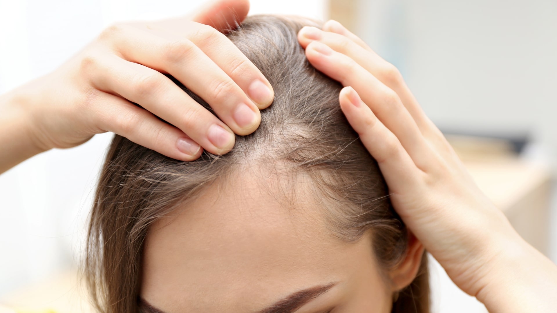 Haarausfall bei Frauen